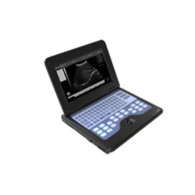 笔记本超声系统